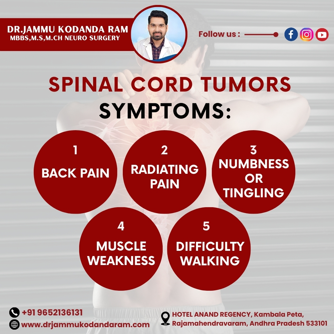 kodandaramdr1's tweet image. Spinal cord tumors can present with a variety of symptoms, depending on their location and size. Common symptoms include persistent back pain, weakness or numbness in the limbs, difficulty walking, tingling sensations, loss of coordination, and, in some cases.#SpinalCordTumor