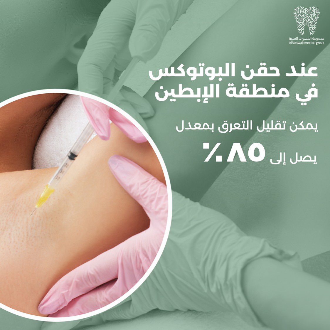 استعد للتخلص من التعرق المزعج واستعادة ثقتك. 
زورونا في المسواك لتكتشفوا المزيد عن بوتوكس التعرق تحت الإبط واستمتعوا بإحساس الراحة.

Say goodbye to unwanted sweat stains and hello to confidence! Visit us at AlMeswak to learn more about Botox for underarm sweating and reclaim your