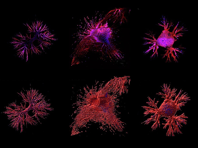 Biomedical Picture of the Day BPoD (@bpod_s) on Twitter photo Branched organoids that represent the diversity of cell types, their shapes and phenotypic plasticity found in #pancreaticcancer (PDAC)
📷: <a href="/arispapargyriou/">Aristeidis Papargyriou</a> et al <a href="/MaxReichertMD/">Maximilian Reichert</a> lab <a href="/TU_Muenchen/">TU München</a> in <a href="/natBME/">Nature Biomedical Engineering</a>
➡️: bpod.org.uk/archive/2024/1… Branched organoids that represent the diversity of cell types, their shapes and phenotypic plasticity found in #pancreaticcancer (PDAC)
📷: <a href="/arispapargyriou/">Aristeidis Papargyriou</a> et al <a href="/MaxReichertMD/">Maximilian Reichert</a> lab <a href="/TU_Muenchen/">TU München</a> in <a href="/natBME/">Nature Biomedical Engineering</a>
➡️: bpod.org.uk/archive/2024/1…