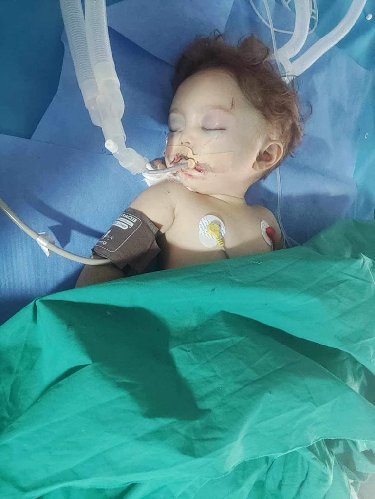 FIDDAUSI121's tweet photo. IN LESS THAN A WEEK

5 BABIES HAVE DIED 

IN GAZA FROM THE 

FREEZING TENTS! https://t.co/HiyZVGPU83