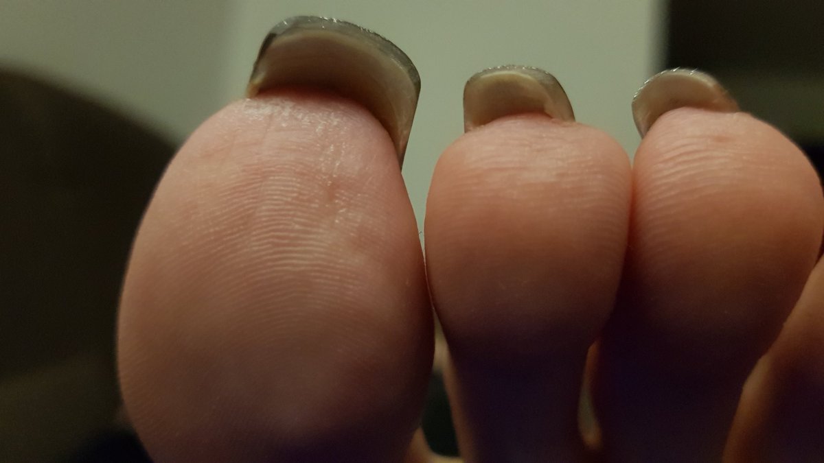 Heel_Danielle's tweet photo. It's a toe! Thanks to all my Quiz contestants. #toes #feet #foot #footfetish #girlsfeet #barefoot #quiz https://t.co/rsT12tAtWm