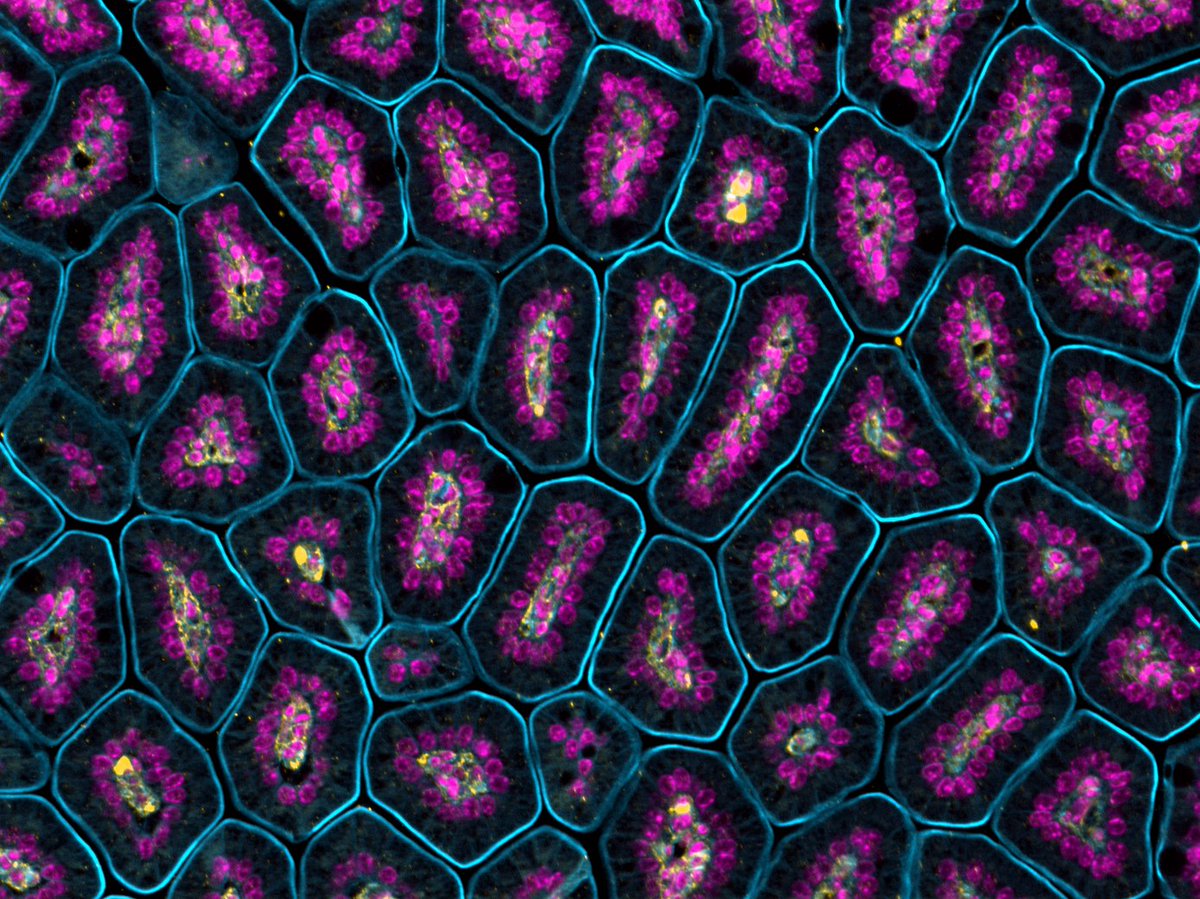 Happy #MicroscopyMonday featuring intestinal villi with the apical membrane in blue, nuclei in purple, and extracellular matrix in yellow.
#miscroscopy #intestine #sciart #histoart #pathart #bioart