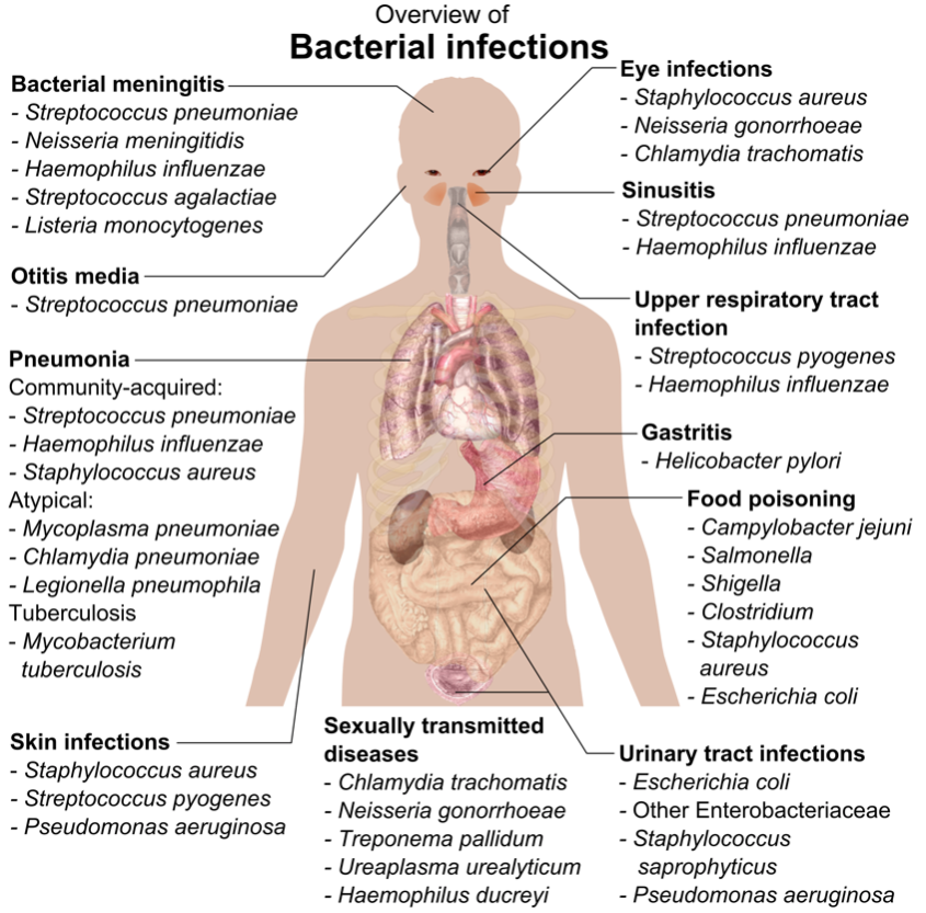 MedicalExamPrep's tweet photo. An overview of bacterial infections #FOAMed #MedEd #MRCEM #MRCGP #PLAB https://t.co/5zC1Rdp0wv