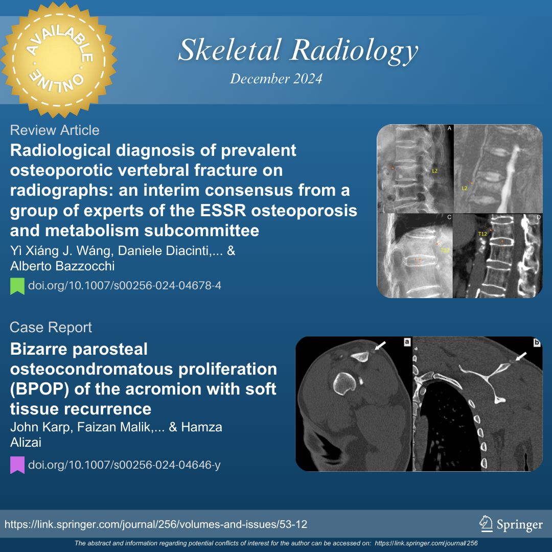Skeletal Radiology (@skeletaljournal) on Twitter photo Take a look at the December edition:
🟢 Revew Article: consensus from a group of experts of the <a href="/ESSRmsk/">European Society of Musculoskeletal Radiology</a> osteoporosis and metabolism subcommittee | buff.ly/4fjD1d2
🟣 Case Report | buff.ly/4fk3Pdc
#SkeletalRadiology #radiology #osteoporosis #orthopedics Take a look at the December edition:
🟢 Revew Article: consensus from a group of experts of the <a href="/ESSRmsk/">European Society of Musculoskeletal Radiology</a> osteoporosis and metabolism subcommittee | buff.ly/4fjD1d2
🟣 Case Report | buff.ly/4fk3Pdc
#SkeletalRadiology #radiology #osteoporosis #orthopedics