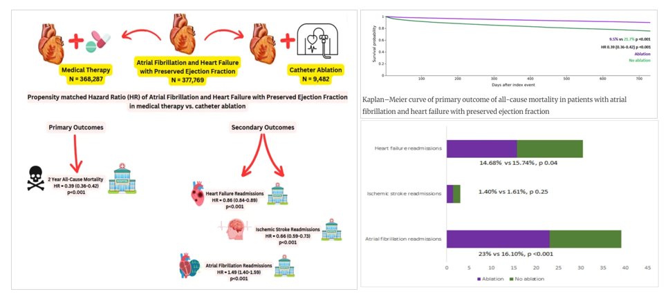 JICE (@jice_ep) on Twitter photo New #FreeRead Article in
<a href="/JICE_EP/">JICE</a>
Long-term Impact of Atrial Fibrillation Catheter Ablation on HF with Preserved Ejection Fraction
🧐📖rdcu.be/d5fyl
by <a href="/harsh_cardio/">Harsh Patel</a>, Rezwan Munshi, <a href="/AakashRSheth/">Aakash R Sheth, MD</a>, <a href="/SidAgarwalMBBS/">Siddharth Agarwal (he/him)</a>, Freddy Del-Carpio Munoz, Guru Kowlgi, <a href="/DrDeese99/">Christopher DeSimone, MD, PhD</a>, New #FreeRead Article in
<a href="/JICE_EP/">JICE</a>
Long-term Impact of Atrial Fibrillation Catheter Ablation on HF with Preserved Ejection Fraction
🧐📖rdcu.be/d5fyl
by <a href="/harsh_cardio/">Harsh Patel</a>, Rezwan Munshi, <a href="/AakashRSheth/">Aakash R Sheth, MD</a>, <a href="/SidAgarwalMBBS/">Siddharth Agarwal (he/him)</a>, Freddy Del-Carpio Munoz, Guru Kowlgi, <a href="/DrDeese99/">Christopher DeSimone, MD, PhD</a>,