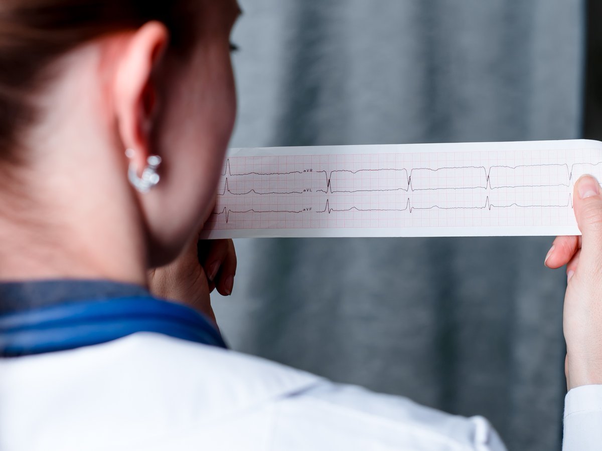 British Heart Foundation (@thebhf) on Twitter photo Nearly 2,000 people have taken part in a groundbreaking trial we're funding that aims to help doctors identify more people at risk of developing atrial fibrillation (AF).
Led by <a href="/cpgale3/">Prof Chris P Gale</a> and <a href="/Dr_R_Nadarajah/">Ramesh Nadarajah</a> at <a href="/UniversityLeeds/">University of Leeds</a> <a href="/LeedsHospitals/">Leeds Teaching Hospitals</a>, the researchers hope the study Nearly 2,000 people have taken part in a groundbreaking trial we're funding that aims to help doctors identify more people at risk of developing atrial fibrillation (AF).
Led by <a href="/cpgale3/">Prof Chris P Gale</a> and <a href="/Dr_R_Nadarajah/">Ramesh Nadarajah</a> at <a href="/UniversityLeeds/">University of Leeds</a> <a href="/LeedsHospitals/">Leeds Teaching Hospitals</a>, the researchers hope the study