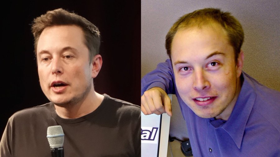This is what Elon Musk looked like before he took hormones, had a hair transplant and plastic surgery.

All stuff that he wants banned for Trans people.