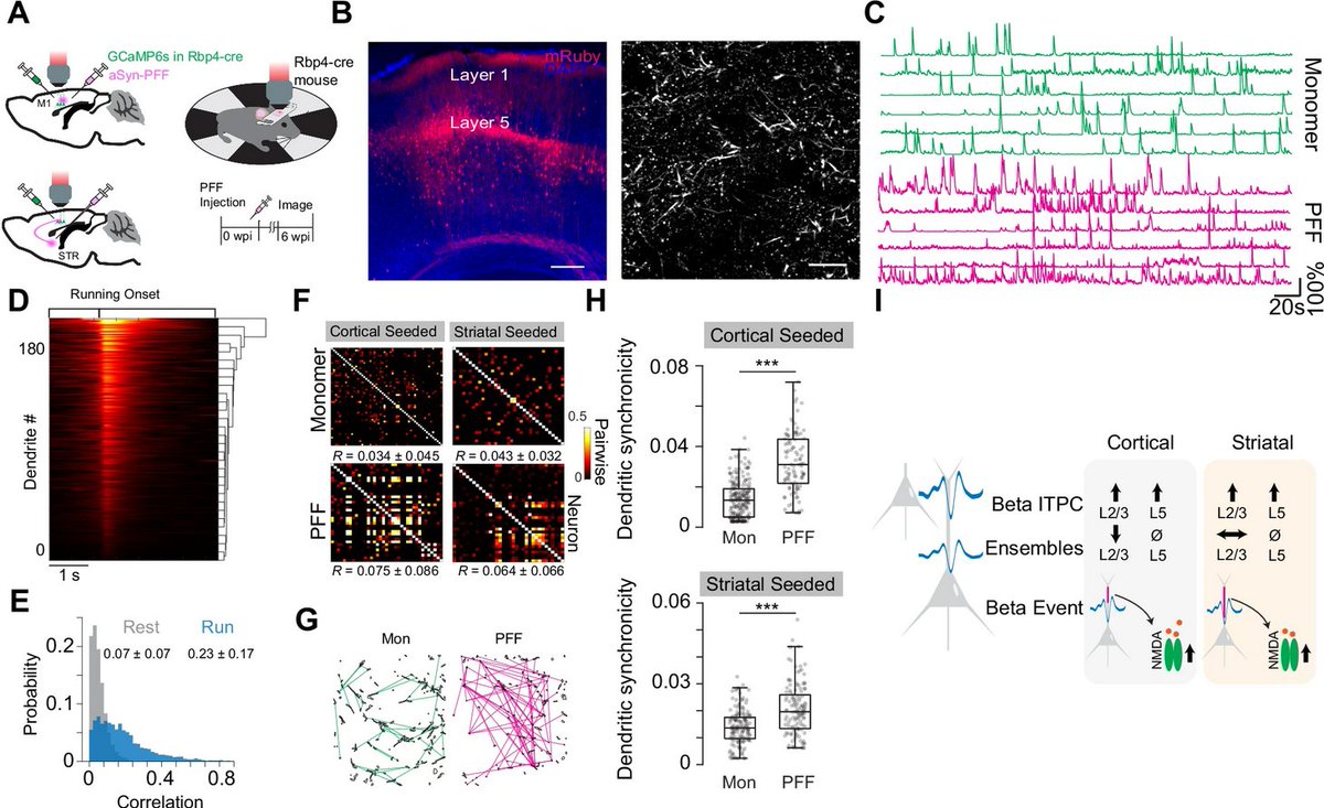 The Science of Parkinson's (@scienceofpd) on Twitter photo New research from <a href="/Hammad_FKhan/">Hammad Khan</a> <a href="/KrishnaJayant/">Krishna Jayant</a> & colleagues finds that site-specific seeding of #Parkinsons-associated Lewy pathology induces distinct pre-motor cellular & dendritic vulnerabilities in the cortex
nature.com/articles/s4146… New research from <a href="/Hammad_FKhan/">Hammad Khan</a> <a href="/KrishnaJayant/">Krishna Jayant</a> & colleagues finds that site-specific seeding of #Parkinsons-associated Lewy pathology induces distinct pre-motor cellular & dendritic vulnerabilities in the cortex
nature.com/articles/s4146…
