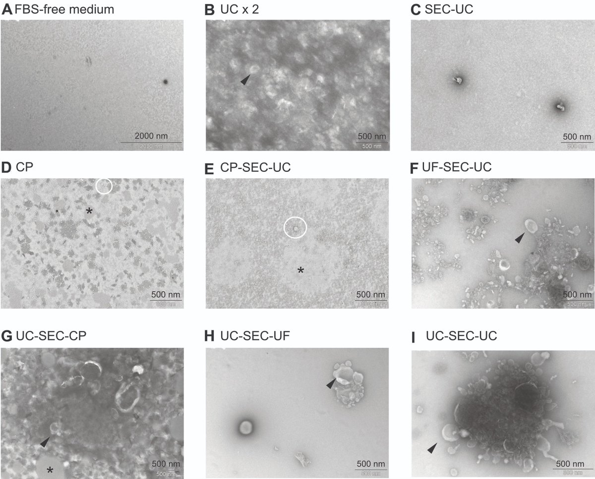 Exploring extracellular vesicles from bovine mammary gland epithelial cells cultured in a FBS-free system! 🧪 Giulia Silvestrelli et al. propose a reliable method using UF-SEC-UC for isolating clean EVs, advancing in vitro EV research. 
🌟 Read more: oaepublish.com/articles/evcna…