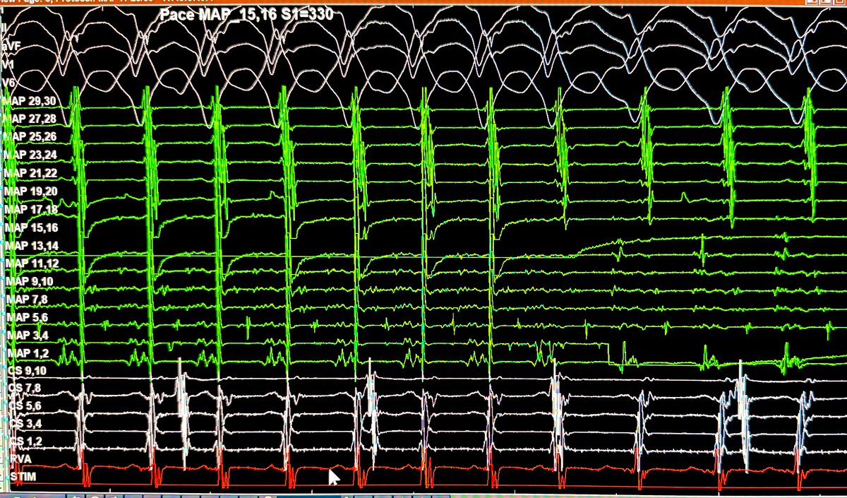 Ashkan Ehdaie MD tweet media