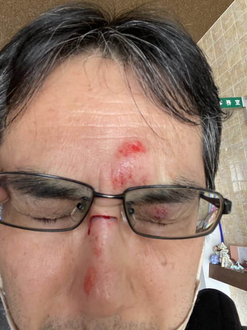 ねんまつ!今年を4枚で振り返る系、画像見返してみたら春に眼鏡ぶっ刺さったり腹ん中から魔石回収したりで結構な厄年だったのかも…昨冬は雪少なかったが暑さと雨続きでバイク作業もほぼガレージ作りで終わったし。来年こそは路上fu(毎年恒例 