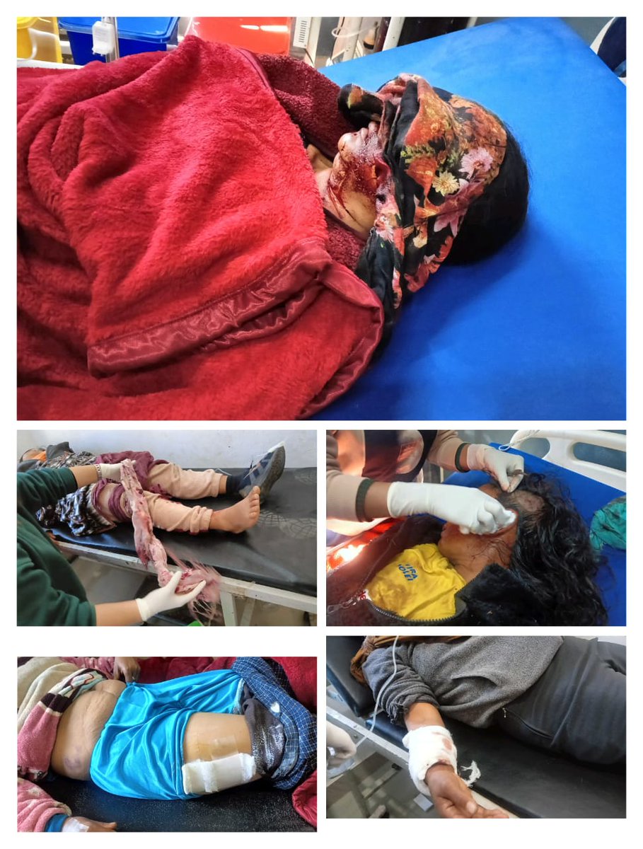 #ManipurViolence 
Strong condamination on Central force' brutality against kuki women, leaving one blind and other injured, is MORALLY REPREHENSIBLE!!
We demand justice accountability and protection now 
Justice for #Saibol women
<a href="/HMOIndia/">गृहमंत्री कार्यालय, HMO India</a> <a href="/IndiaTodayNE/">India Today NE</a> 
<a href="/highbold_act/">Unknown True</a> <a href="/hi/">hi</a>