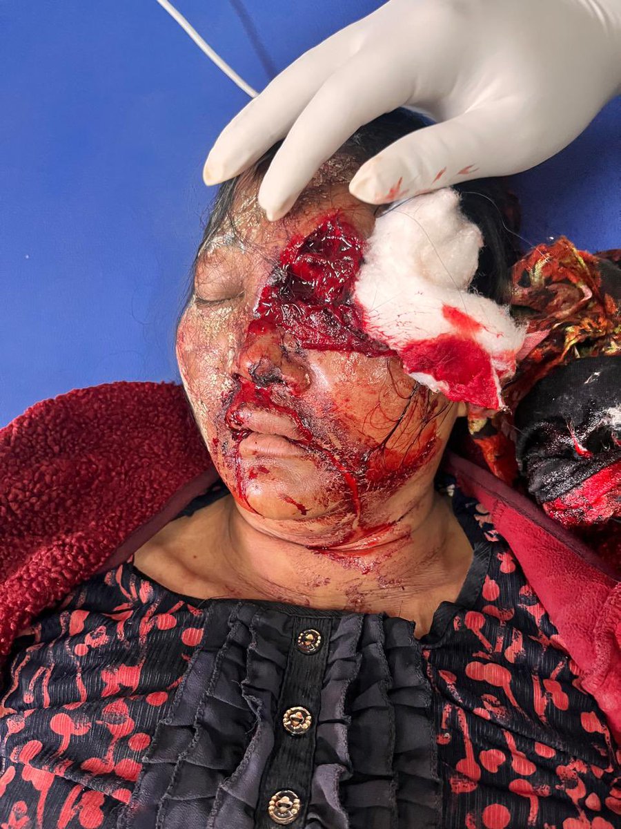 TLThangkhoginHK's tweet photo. #ManipurViolence

#SAIBOL_KUKIHILLS
ATROCITY of #Centrealforces.
This is how state govt.Misused the centre force to annihilated the #KUKI from INDIA.
Centre govt.should take immediate action
Follow bufferzone created by MHA.@crpfindia @BSF_India 
@UN @UN_Women @UNHumanRights https://t.co/yBffT9YSLx