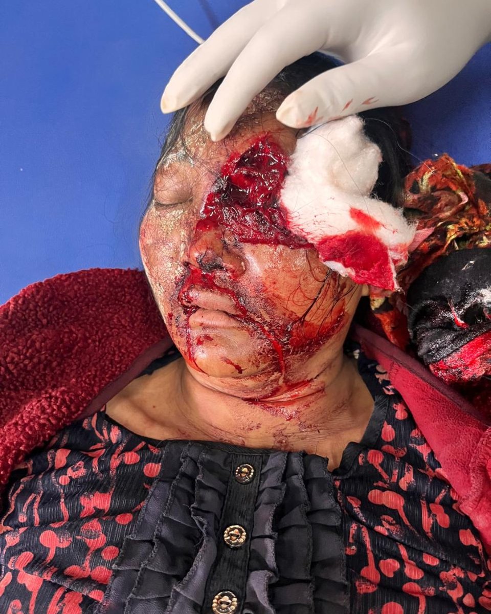 luntelvumkukipa's tweet photo. #ManipurViolence

#SAIBOL_KUKIHILLS
ATROCITY of #Centrealforces.
This is how state govt.Misused the centre force to annihilated the #KUKI from INDIA.
Centre govt.should take immediate action
Follow bufferzone created by MHA.@crpfindia @BSF_India 
@UN @UN_Women @UNHumanRights https://t.co/nd8ua5eWBU