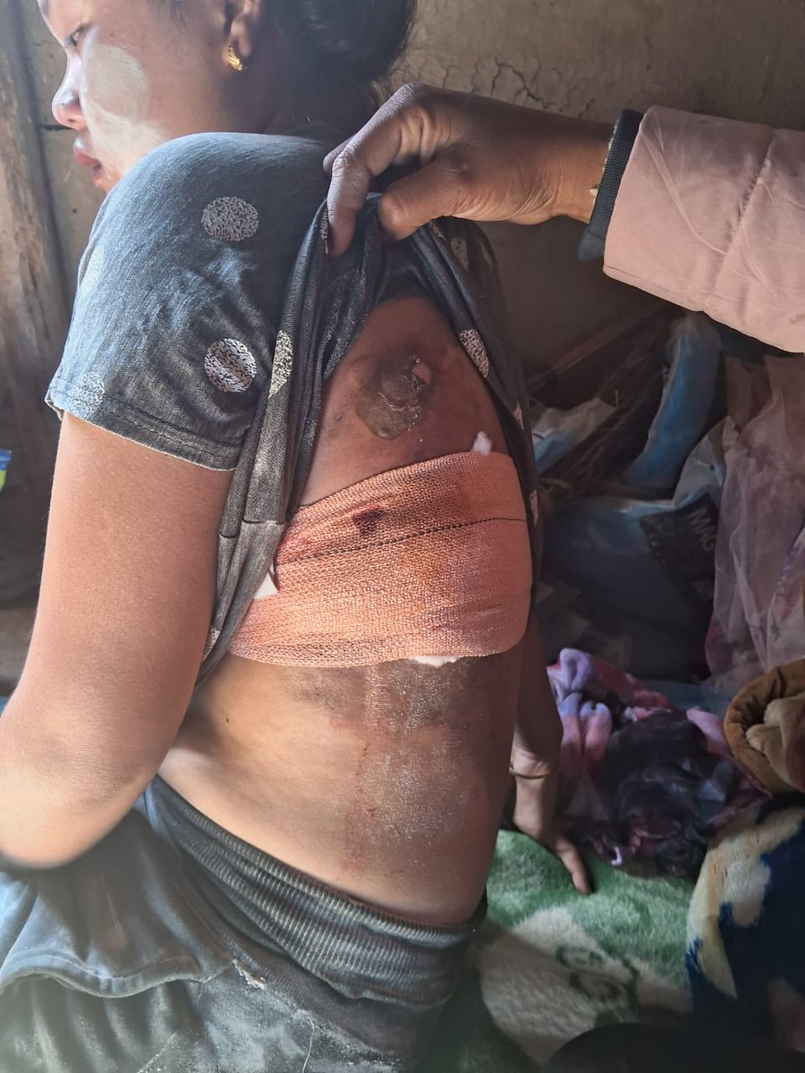 JShakurB's tweet photo. The despicable &amp; inexhaustible actions of @crpfindia who subjected unarmed women to brutal violence,sexual assault with deliberate attempt to maim &amp; blind is a sickening &amp; searing indictment of a system that has lost all sense of humanity,professionalism &amp; decency.
@unwomenindia https://t.co/YaY6EO60XN