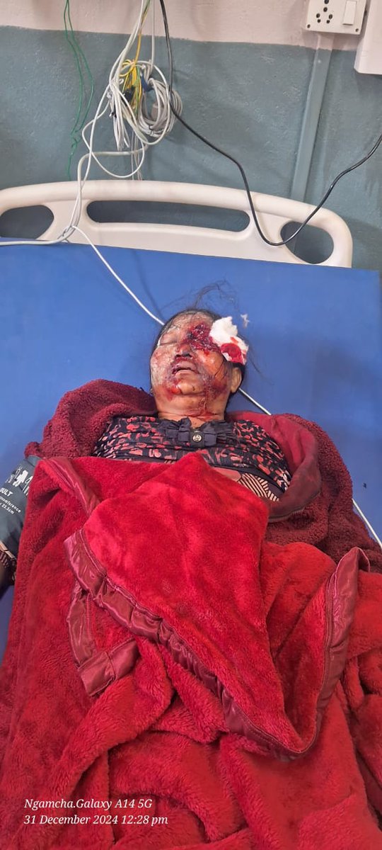 MHaokipp85232's tweet photo. 📍Saibol, Manipur: Kuki women face tear gas, assault, and stripping for protesting. @PMOIndia @HMOIndia, demand accountability
#savesaibolfromCRPFatrocities https://t.co/Vj7Go1urVv
