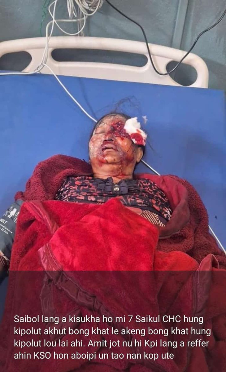 KipsKuki's tweet photo. We urge the @unwomenindia @NCWIndia @UNHumanRights @UNHumanRightsEU @UNHumanRightsUA @TribalAffairsIn @ncsthq @UN @India_NHRC to call for accountability from the bias central forces @crpfindia &amp; @BSF_India.
They allowed meiteis to attack us &amp; manhandle our women for protesting. https://t.co/J6UgtEar7j