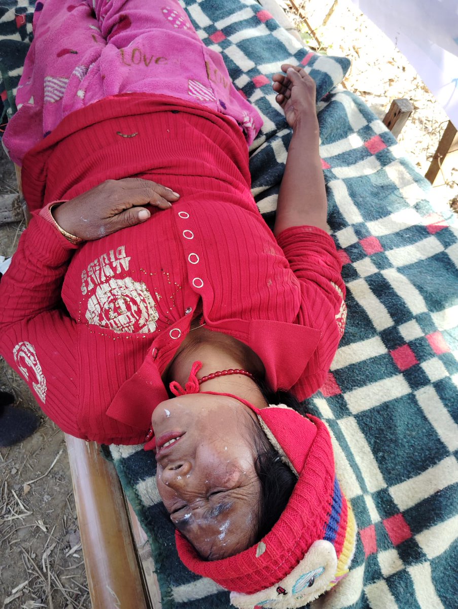 Foxtrotwolf2020's tweet photo. 🚨#Manipur #Breaking #Emergency 🚨
The brutality of CFs like @crpfindia & @BSF_India knows no bounds.
They unleashed a reign of terror over helpless innocent #Kuki_Zo women at Saibol village, kangpokpi district.
This dastardly acts is reprehensible & shows their leanings towards the secessionist #MeiteiNarcoTerrorist.
They allowed meiteis to cross the BUFFER ZONES & attacked the minority community.

#ManipurViolence
@adgpi @official_dgar
@Spearcorps @BSF_India
@crpfindia @PMOIndia @HMOIndia @unwomenindia @unwomenasia @UNWomenWatch 
@narendramodi @AmitShah @rajnathsingh @RahulGandhi @kharge  @BJP4India
@INCIndia @TOIIndiaNews @IndiaTodayNE @thewire_in @TheQuint @ThePrintIndia
@htTweets @thecaravanindia @frontline_india
@IndiaTodayNE @CNNnews18 @the_hindu 
@BBCBreaking @ndtv
@AJEnglish  @PTI_News @FoxNews @PTI_News
@ZeeNews @SAsiaSolidarity @UN
@UNHumanRights