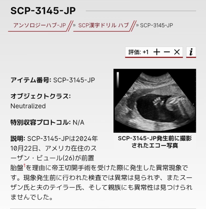 【投稿報告 Day Final】

SCP-3145-JP - "て"は「帝王切開」の"て"
が投稿されました。

scp-jp.wikidot.com/scp-3145-jp