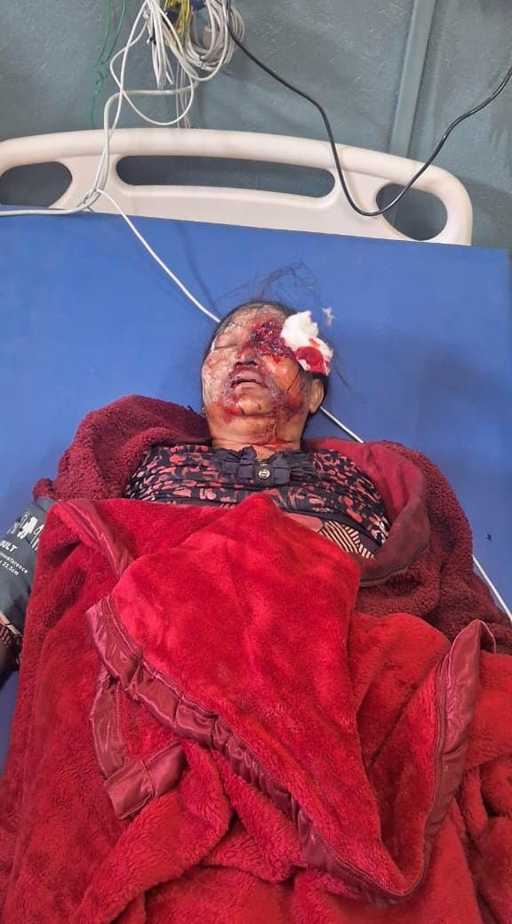 Minimum force !?
Really !?
Was this 'minimum' force used against the Valley Meira Paibis !?!??!?
Or this 'minimum' force is ONLY for the Hills !?

#Manipur #ManipurViolence