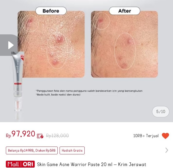 Raradew0's tweet photo. Obat totol jerawat ternampol, malem nya pake ini paginya langsung kering emang terdebest sih 😭😍buruan cek mumpung lagi diskon😭

•skin game acne Warrior 
Obat totol jerawat 
https://t.co/lGzkPSAheT https://t.co/n338YVPxG7