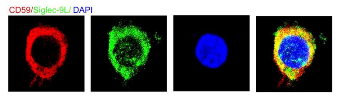 Journal of Clinical Investigation (@jclinicalinvest) on Twitter photo How do prostate tumor cells dodge the immune system? jci.org/articles/view/…
<a href="/Ru_M_Wen/">Ru Wen</a> & team reveal an interaction between sialic acid-modified proteins on tumor cells and Siglec7/9 on immune cells and identify CD59 as a candidate for targeting!
<a href="/JessicaCStark/">Jessica Stark</a> <a href="/riley_nm1/">Nick Riley</a> How do prostate tumor cells dodge the immune system? jci.org/articles/view/…
<a href="/Ru_M_Wen/">Ru Wen</a> & team reveal an interaction between sialic acid-modified proteins on tumor cells and Siglec7/9 on immune cells and identify CD59 as a candidate for targeting!
<a href="/JessicaCStark/">Jessica Stark</a> <a href="/riley_nm1/">Nick Riley</a>