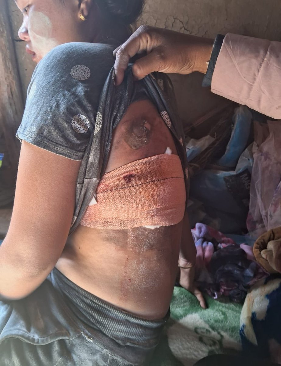 KukiZo1437's tweet photo. @EditorRajan Kuki-Zo women were molested, beaten and shot at. One woman had her eyes gouged out (Last pic) https://t.co/G72eNYtJCw