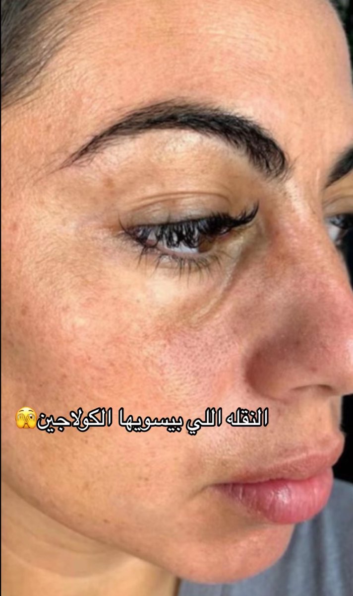 Ghad0A's tweet photo. الحين صدق الكولاجين يحّسن البشره ويعطيها نظاره كذا؟ 
عطونا تجاربكم بنات وايش النوع اللي تستخدمونه https://t.co/jlQmQ3FOQs