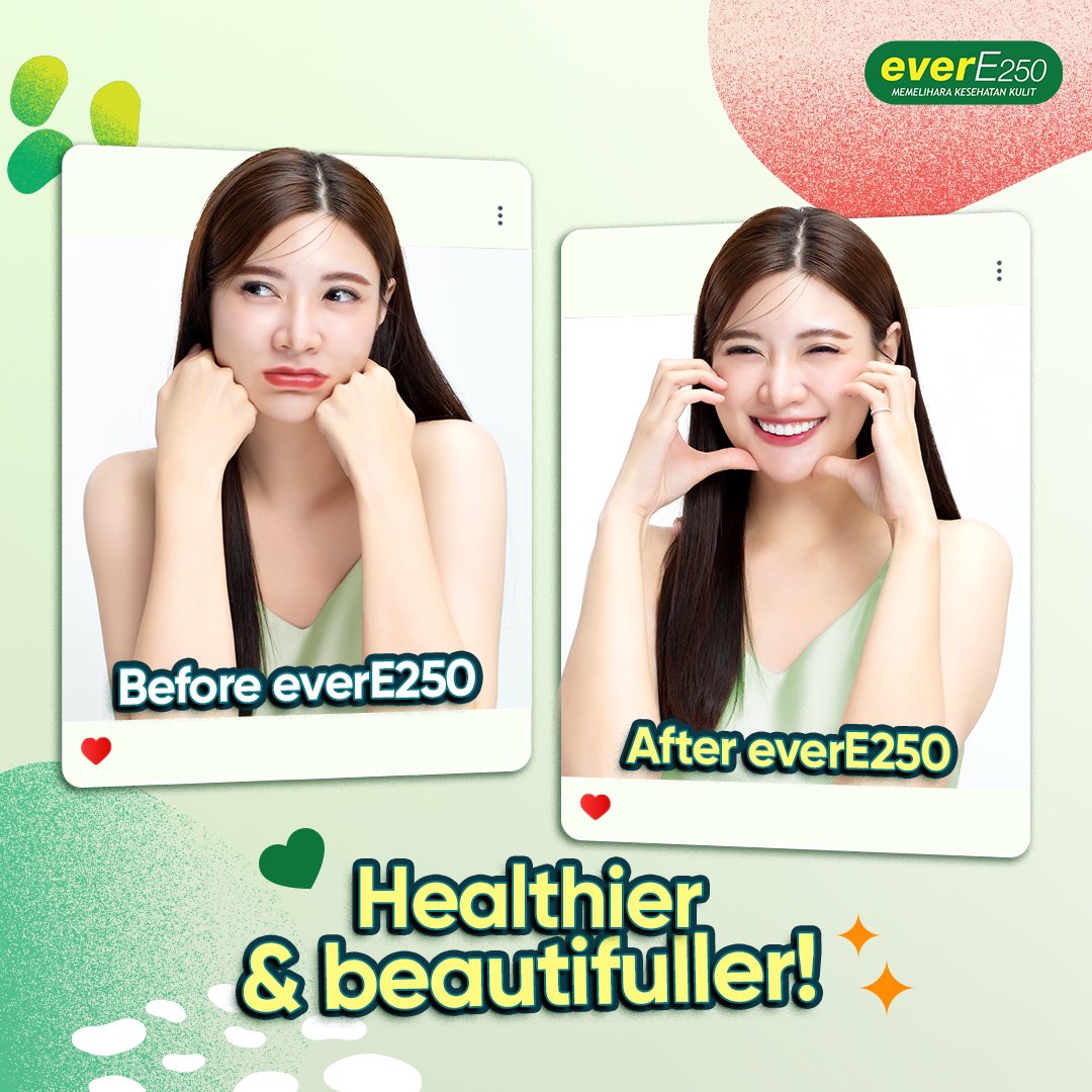 Ever E Indonesia tweet media