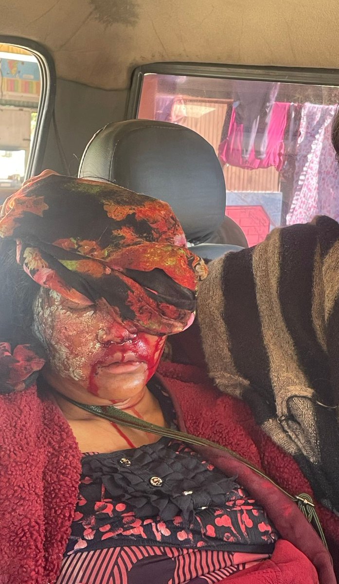 BemLhungdim's tweet photo. Manipur: While the world celebrates New year, Kuki women of Saibol village were physically assaulted by the combined team of @crpfindia &amp; @BSF_India , their only fault was defending their land from the continuous attack of #MeiteiTerrorists . Hang your head in shame https://t.co/L8zdeFODrp
