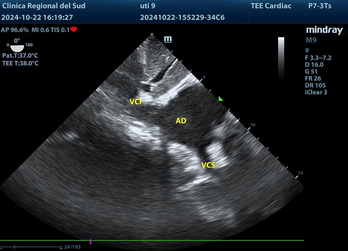 Martin Cruz Isa tweet media