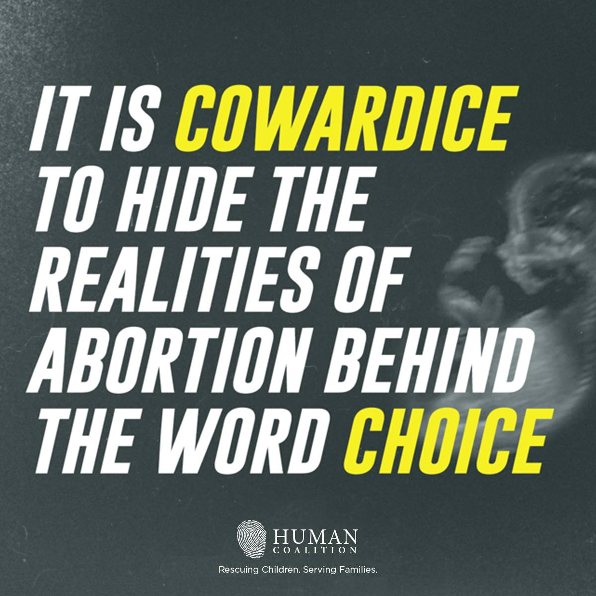 MomC98765's tweet image. Pregnancy is not a punishment for having sex.  It is sometimes the natural result of having sex. The birth of a baby is the natural conclusion of pregnancy. Killing the human being that resulted from your actions is homicide. #prolife #prochoice