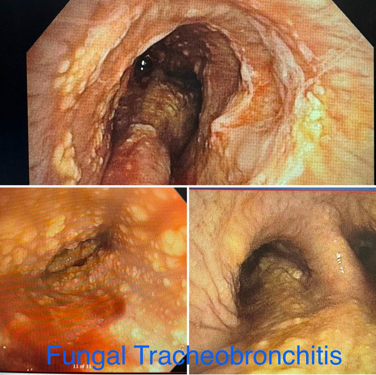 Ali Abedi MD FCCP DAABIP tweet media