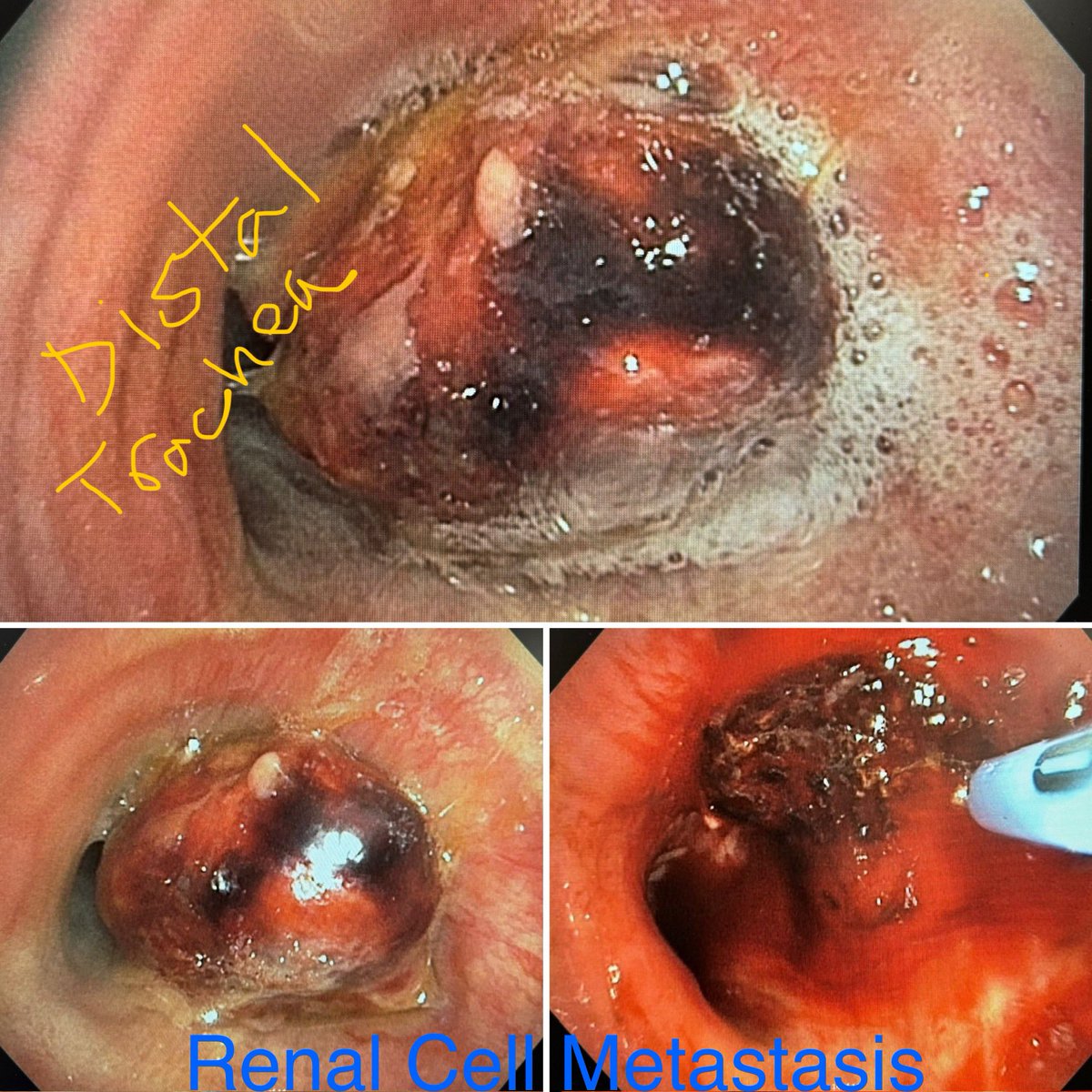 Ali Abedi MD FCCP DAABIP tweet media