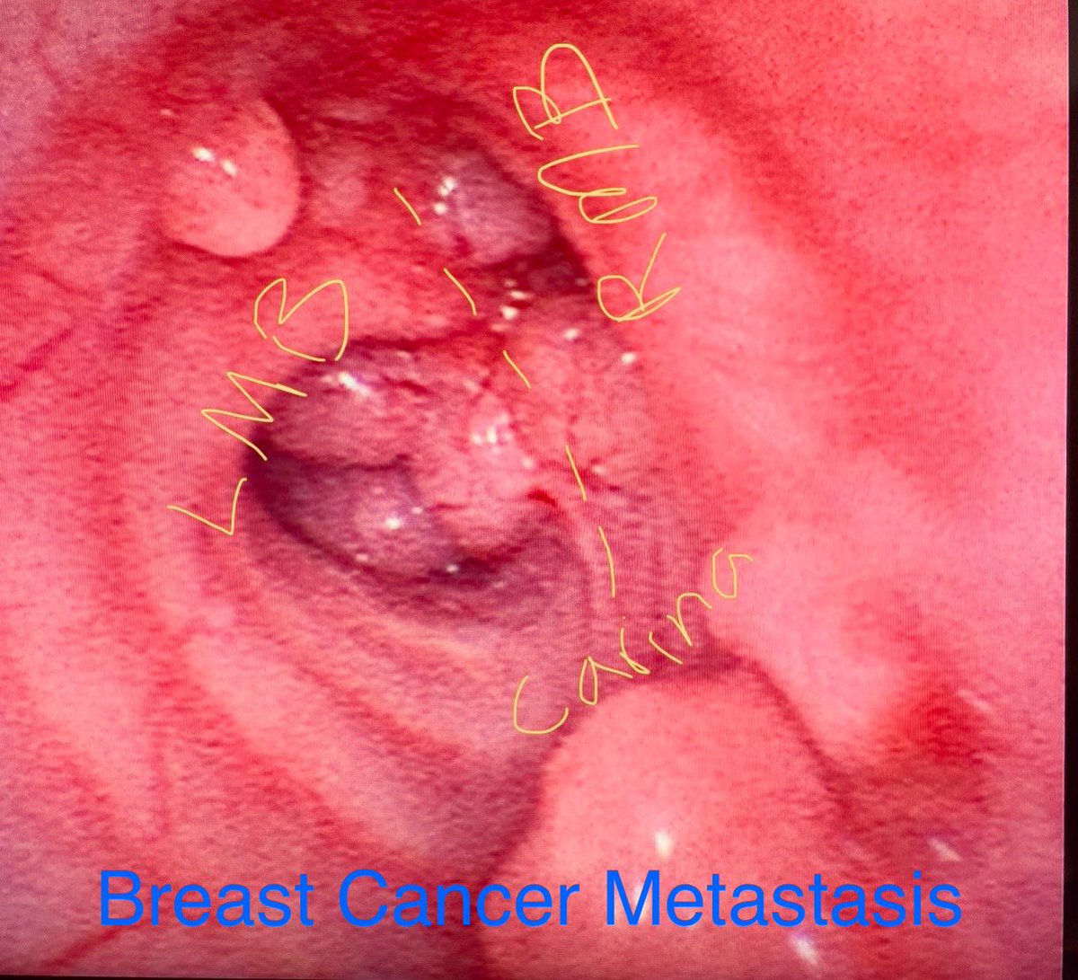 Ali Abedi MD FCCP DAABIP tweet media