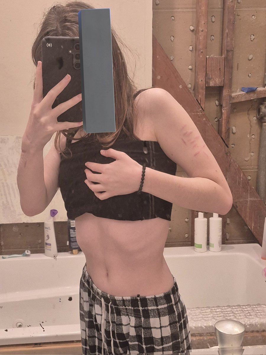 skinnyxdietcok3's tweet photo. Am I thin or fat?
#anatwt #edtwt #thinspotwt #thinbody #bulimia #anorexia https://t.co/Q73tR3KcMZ