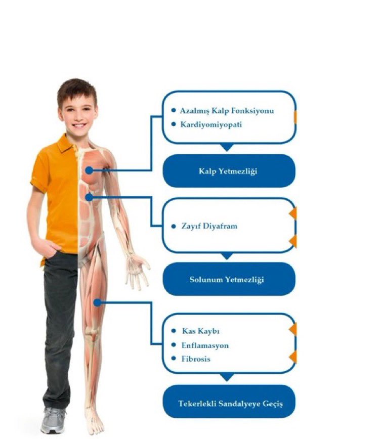 Her 3500 erkek çocuğundan biri Duchenne musküler Distrofi hastalığı ile dünyaya gelir. Farkındalık ile hayatları desteklenebilir.

#7500AileİlaçBekliyor