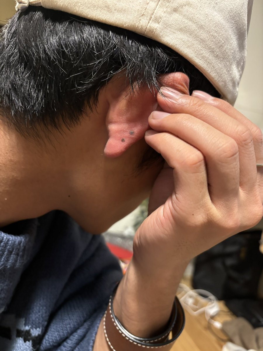 生きぼくろかどうかわかる人いますか？