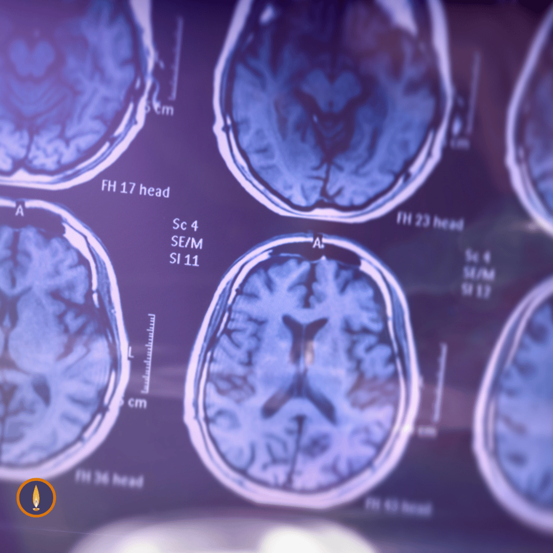 rajeshananda's tweet image. Rajesh Ananda has spoken often about how stress can affect brain function and cleaning to increase the possibility of developing Dementia and Alzheimer’s.  Read the article:  bit.ly/4gV2ASF

#dementia #brainfunction #alzhiemers #meditation #fisumeditation #mentalhealth