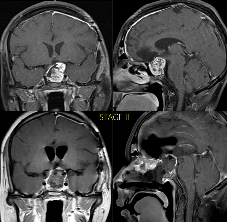 Ahmed Mohyeldin MD PhD (@mohyeldinahmed) on Twitter photo 2024 has been an incredibly big year! Looking forward to all the challenges that 2025 has to bring and thankful to serve the brain tumor patients of Southern California with the incredible clinicians, scientists, staff and especially residents at <a href="/UCIrvineHealth/">UCI Health</a> who are committed 2024 has been an incredibly big year! Looking forward to all the challenges that 2025 has to bring and thankful to serve the brain tumor patients of Southern California with the incredible clinicians, scientists, staff and especially residents at <a href="/UCIrvineHealth/">UCI Health</a> who are committed