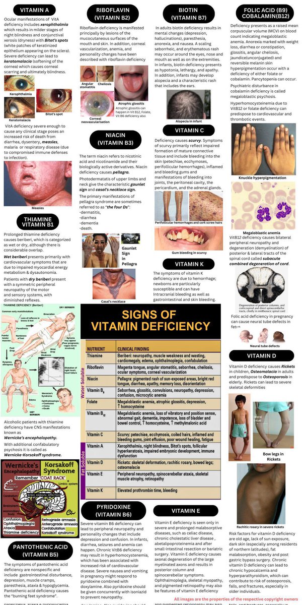 abdulhamid_199's tweet image. صورة تختصر لك 
  
VITAMIN DEFICIENCY - Signs

جدا حلوة وتعتبر شاملة