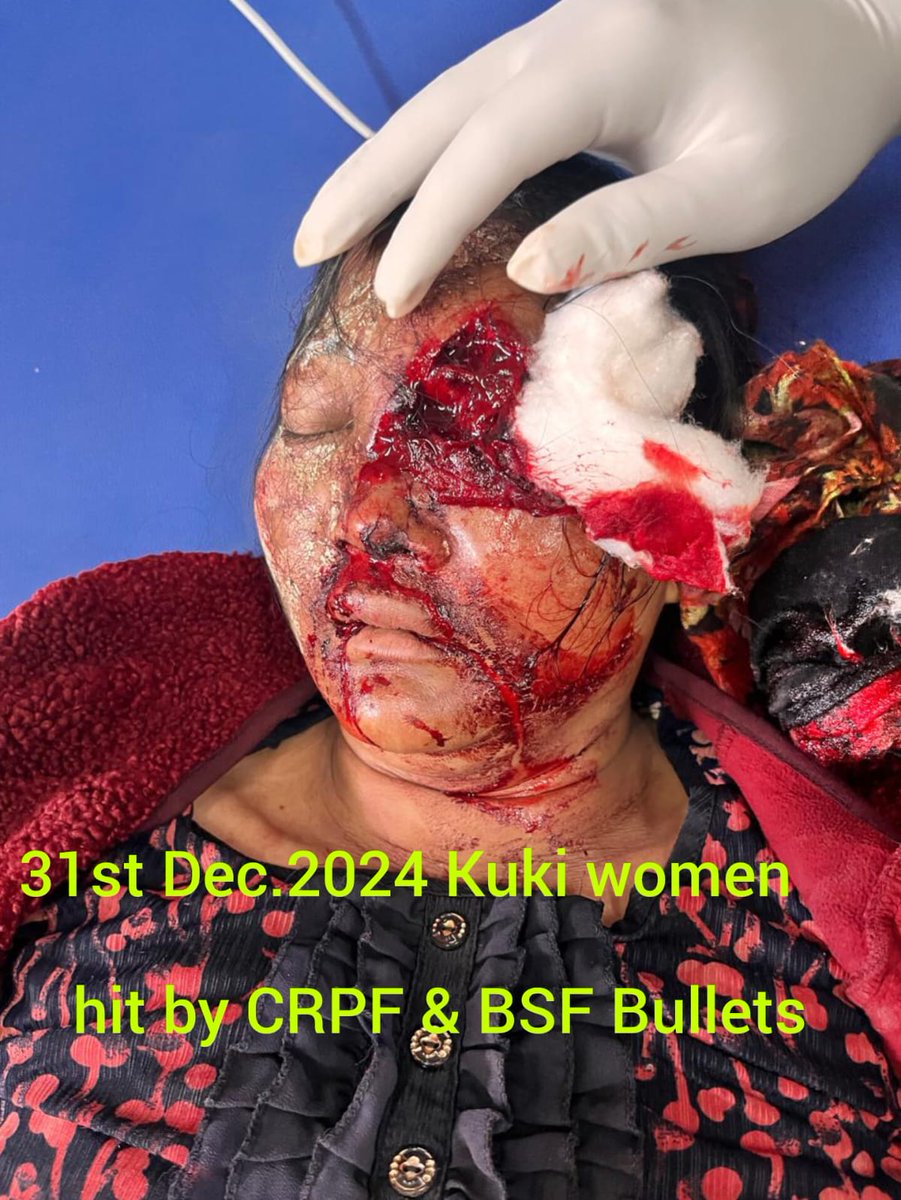 Chhotu_Vasava's tweet photo. 📍Saibol:Why @crpfindia  @BSF_India reportedly used tear gas and lathi charges against innocent Tribal women? resulting in serious injuries to 42 of them. Some women suffered eye injuries, causing permanent vision loss.
#ManipurViolence
@UNHumanRights #ManipurViolence https://t.co/cXHtYe6aFs