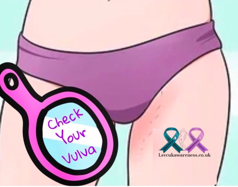 Make 2025 the year you start checking your vulva regularly 💜#KnowYourNormal