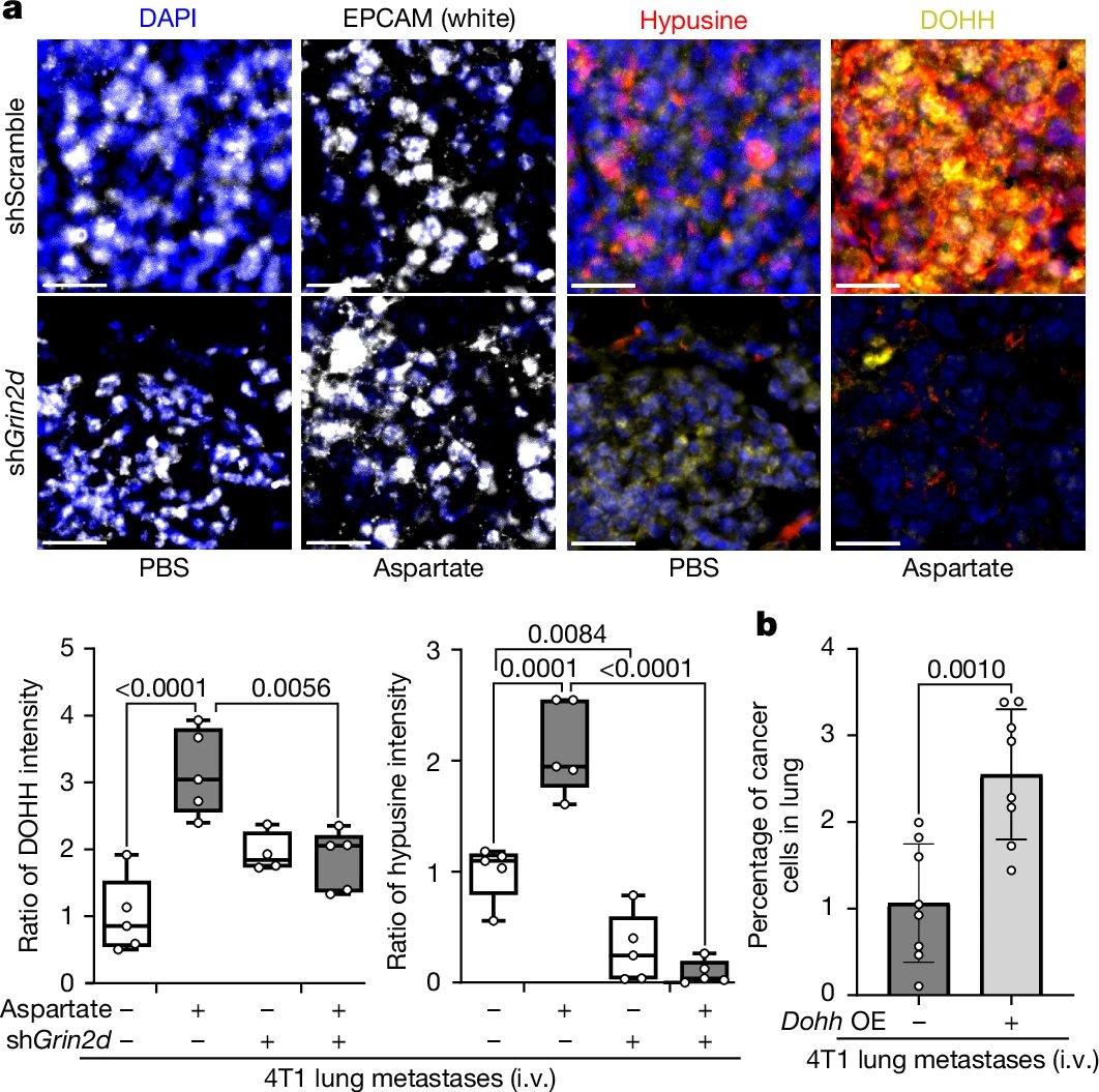 Aspartate signaling drives lung metastasis via alternative translation
<a href="/Nature/">nature</a> <a href="/Gysurf/">Ginevra Doglioni</a>
nature.com/articles/s4158…