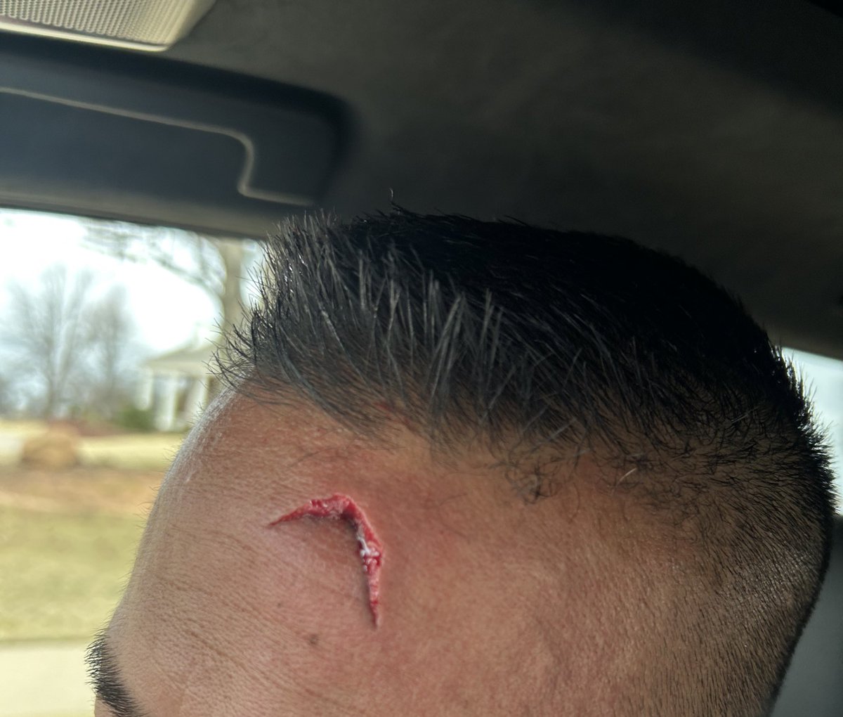 EdwardHowardII's tweet photo. Also, DAMNIT Coach!!!!!! Had my son in law change out my hitch and it looks like he got changed instead! Let’s stick to the little league team coach. We can’t let them see where you’re weak.
-Ed #BobStoops https://t.co/60BSIUgUgM