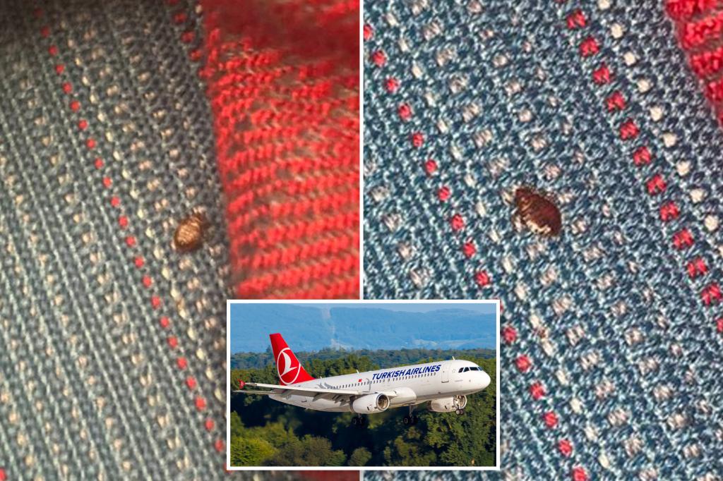 nypost's tweet photo. Turkish Airlines’ flights are riddled with bedbugs, passengers say https://t.co/E94RGoENoE https://t.co/FQuW8Dh71V