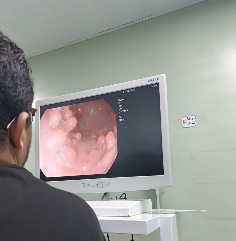 ShakerSky's tweet photo. Polypoidal form of GAVE (gastric antral vascular ectasia) with one polyp at 12 o'clock showing abnormal mucosal pattern. https://t.co/2ZbCTw4DXw