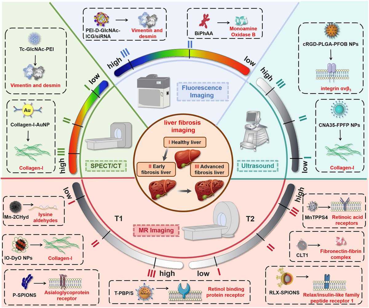 #BMEMat  "Recent advances of nanomaterials in imaging liver fibrosis" by Xinya Zhao and Xiao Sun.
<a href="/WileyBiomedical/">Wiley Biomedical Science</a>

PDF👇
onlinelibrary.wiley.com/doi/epdf/10.10…