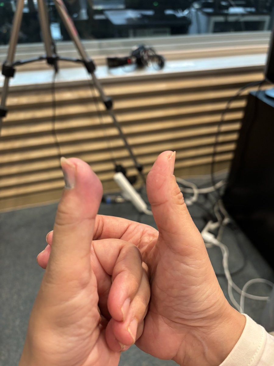 明けましておめでとう御座います🎍⛩️🎍
昭和100年だヨ！全員集合！昭和歌謡リクエスト、始まりました♬😊
そんな初っ端からやらかしました🤣出社する寸前、車のドアで左親指を挟み腫れ上がってます💦こんなになるとは…痛いかも😅
#RKBラジオ #正月からやらかした #痛い #rkb_ocha