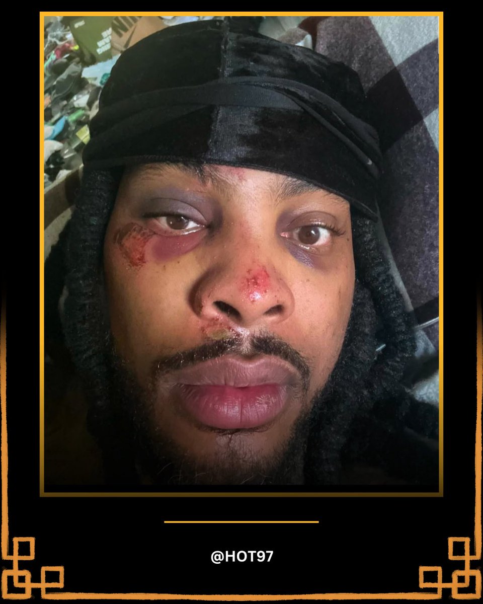 HOT97's tweet photo. Waka Flocka hits the internet showing he was jumped by 10 people! π³π #WakaFlocka @WakaFlocka https://t.co/2GpHlDOJ7j